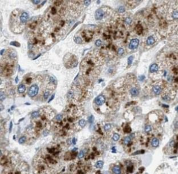 TFF2 Rabbit Polyclonal Antibody