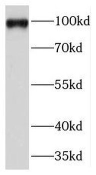 TFIP11 Rabbit Polyclonal Antibody