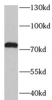 TGFBI Rabbit Polyclonal Antibody