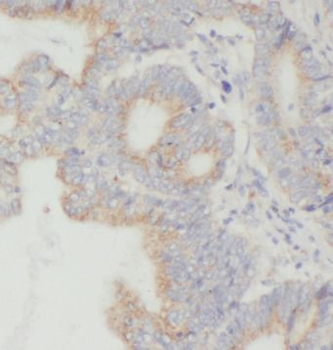 TGFBI Rabbit Polyclonal Antibody