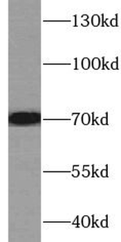 TGFBI Mouse Monoclonal Antibody