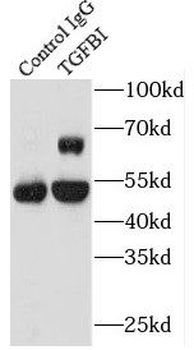 TGFBI Mouse Monoclonal Antibody