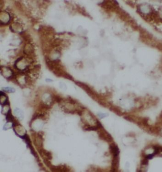 TGFBI Mouse Monoclonal Antibody