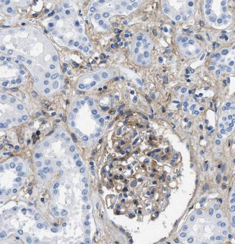 TGFBRAP1 Rabbit Polyclonal Antibody
