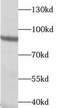 TGM5 Rabbit Polyclonal Antibody