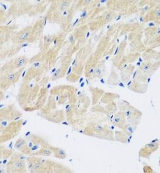 TGM5 Rabbit Polyclonal Antibody