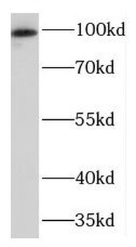 TGOLN2 Rabbit Polyclonal Antibody