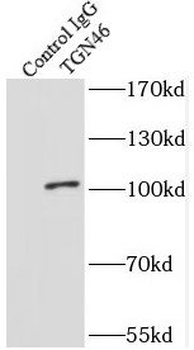 TGOLN2 Rabbit Polyclonal Antibody