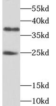 THAP1 Rabbit Polyclonal Antibody