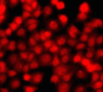 THAP1 Rabbit Polyclonal Antibody