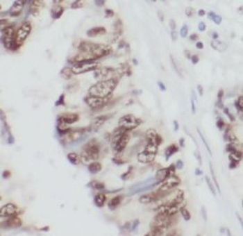 THAP1 Rabbit Polyclonal Antibody
