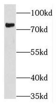 THOC5 Rabbit Polyclonal Antibody