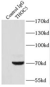 THOC5 Rabbit Polyclonal Antibody