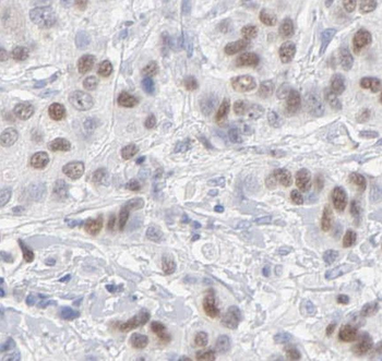 THOC5 Rabbit Polyclonal Antibody