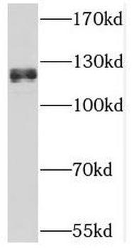 THRAP3 Rabbit Polyclonal Antibody