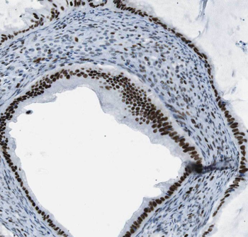 THRAP3 Rabbit Polyclonal Antibody