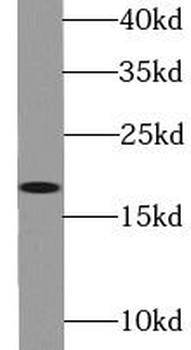 THRSP Rabbit Polyclonal Antibody