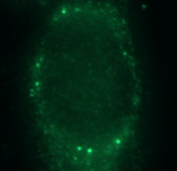 THRSP Rabbit Polyclonal Antibody
