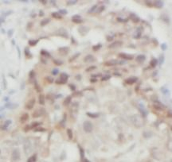 THRSP Rabbit Polyclonal Antibody