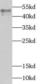 TIA1 Rabbit Polyclonal Antibody