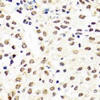 TIA1 Rabbit Polyclonal Antibody