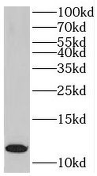MYO18A Rabbit Polyclonal Antibody
