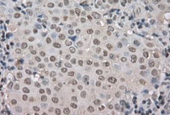 MYO18A Rabbit Polyclonal Antibody