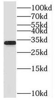 TICAM2 Rabbit Polyclonal Antibody