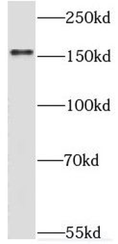 TIE1 Rabbit Polyclonal Antibody