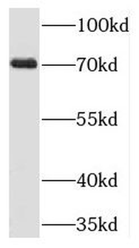 TIGD1 Rabbit Polyclonal Antibody