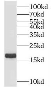 TIMM17B Rabbit Polyclonal Antibody