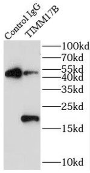 TIMM17B Rabbit Polyclonal Antibody
