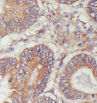 TIMM17B Rabbit Polyclonal Antibody