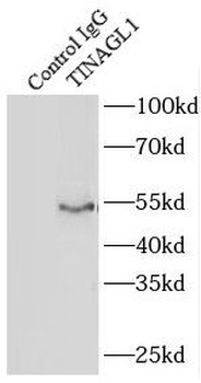 TINAGL1 Rabbit Polyclonal Antibody