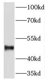 PLIN3 Rabbit Polyclonal Antibody