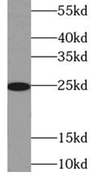 TK1 Rabbit Polyclonal Antibody