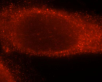 TK1 Rabbit Polyclonal Antibody