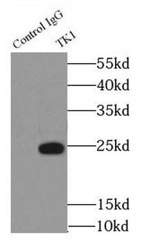 TK1 Rabbit Polyclonal Antibody