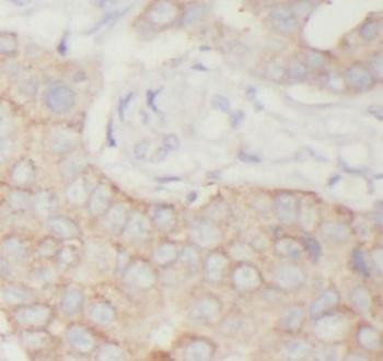 TK1 Rabbit Polyclonal Antibody