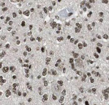 TLE1 Mouse Monoclonal Antibody