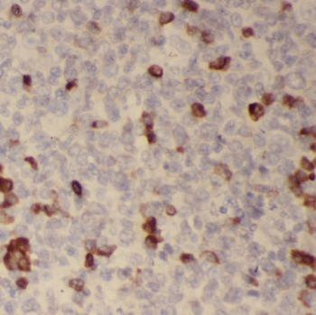 TLR3 Rabbit Polyclonal Antibody