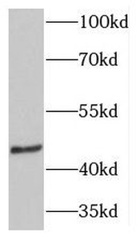 TMEFF2 Rabbit Polyclonal Antibody