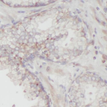 TMEFF2 Rabbit Polyclonal Antibody