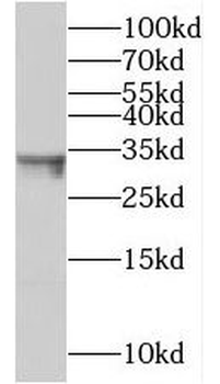 TMEM106B Rabbit Polyclonal Antibody
