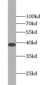 STING1 Rabbit Polyclonal Antibody