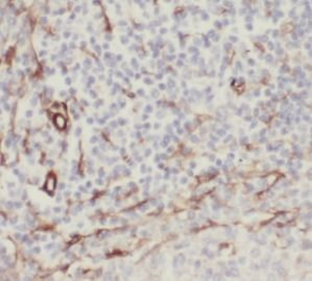 STING1 Rabbit Polyclonal Antibody