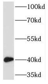 TMOD2 Rabbit Polyclonal Antibody