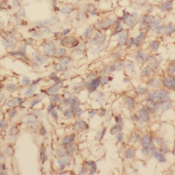 TMOD2 Rabbit Polyclonal Antibody