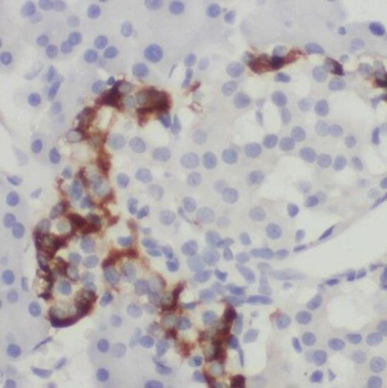 TMED10 Rabbit Polyclonal Antibody