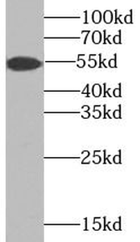 TMPRSS4 Rabbit Polyclonal Antibody